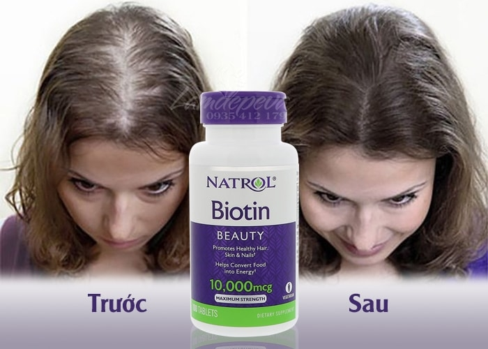 Thuốc mọc tóc Biotin của Mỹ 